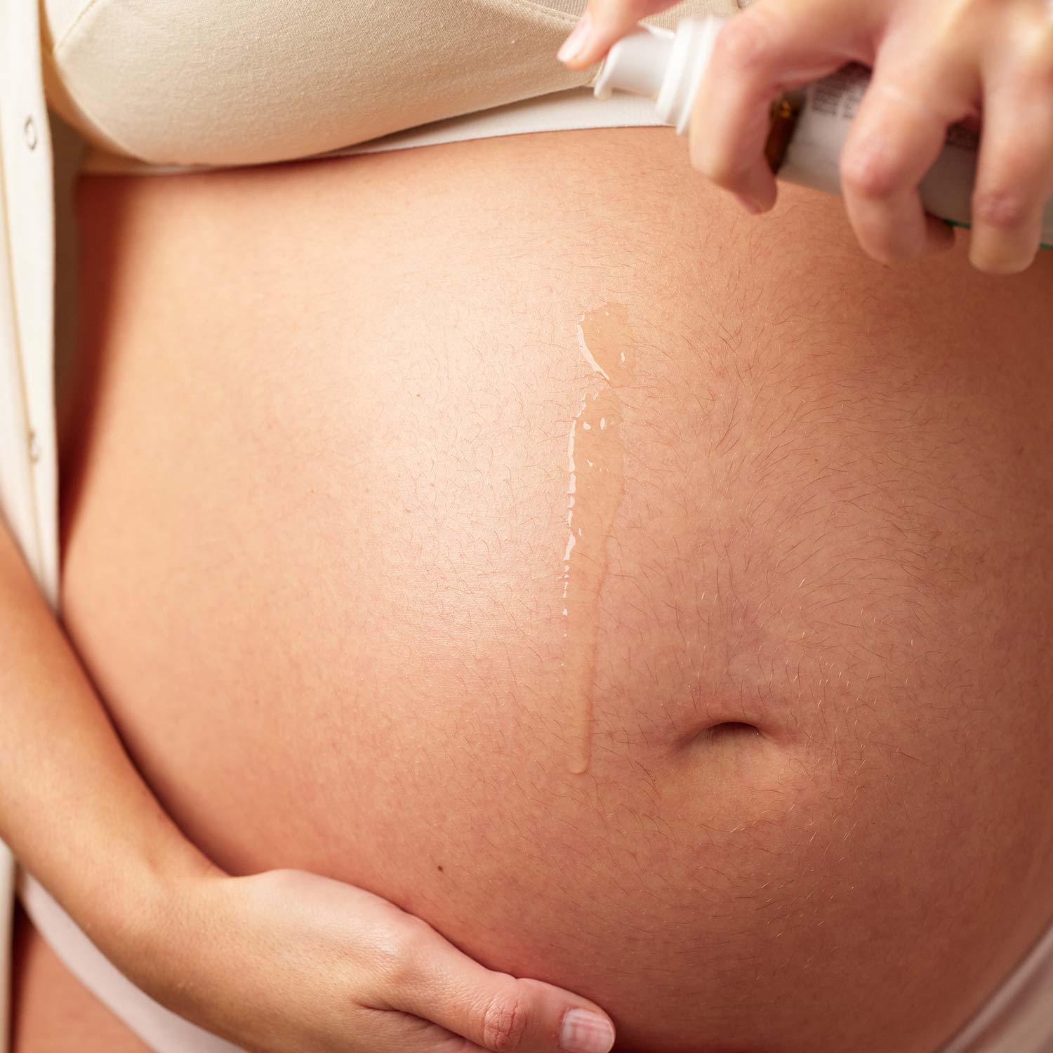 Ulei anti vergeturi pentru corp – ingrijire in sarcina si postpartum, 50ml